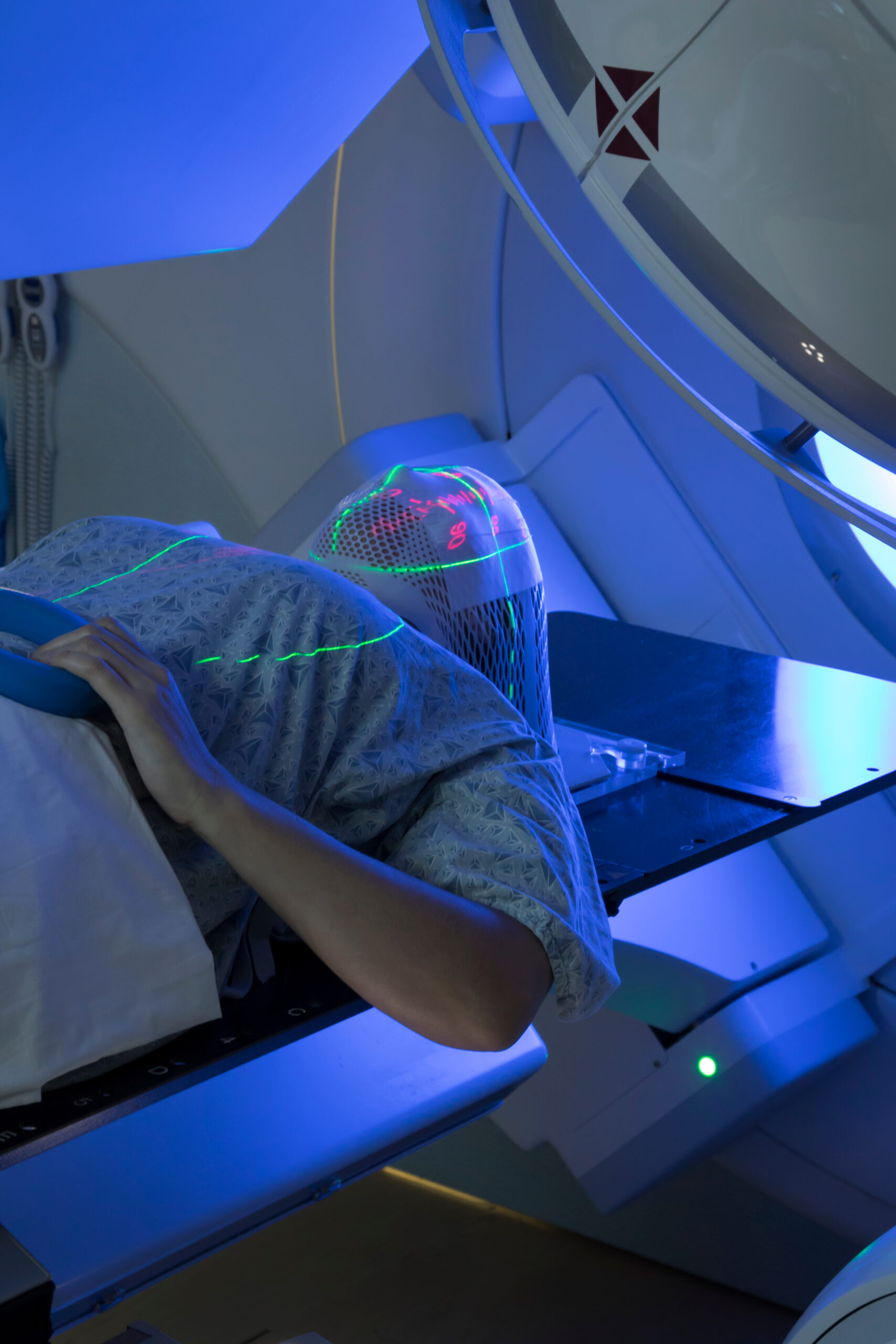 Radiotherapy Solutions Changing Delivery Improving Quality